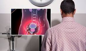 Prostate cancer is the most common cancer among men. Prostate Cancer Weak Or Slow Urine Stream Is A Symptom Express Co Uk