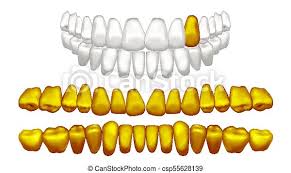 You may also like 3d gold ribbon around tooth or tooth icon set clipart! Gold Tooth Vector Metal Golden Human Teeth Old Pirate Realistic Isolated Illustration Golden Tooth Vector Metal Gold Canstock