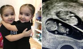 Anak kembar sangatlah unik walaupun terkadang ketika membesarkannya orang tua akan selain faktor genetika, memiliki anak kembar juga ada tips tertentu. Tips Nak Dapatkan Anak Kembar Doktor Dr Hamid Arshat Kongsi 8 Rahsia Dapatkan Anak Kembar Kartel Dakwah