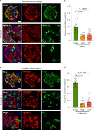 Alle beteiligten stellen arbeiten eng und intensiv zusammen, so der minister. Sars Cov 2 Infects And Replicates In Cells Of The Human Endocrine And Exocrine Pancreas Nature Metabolism