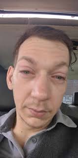 Watching midsomer again and i noticed that all the people that ended up  dead all died with their eyes open wonder if they put eye drops in to stop  them from drying