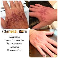 Pin Auf Essential Oils