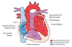 Hertz will likely emerge from chapter 11 bankruptcy protection by the end of the month after a bankruptcy court confirmed the reorganization plan for the beleaguered car rental company. Pda Asd Vsd Avsd Diagram Quizlet