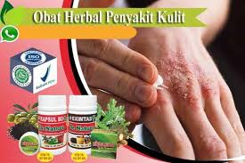 Obat salep gatal eksim kering dan basah di apotik kimia farma category: Obat Eksim Di Apotik Kimia Farma Paling Ampuh Obat Gatal Obat Exim