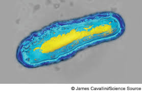 Less frequently, cases involving type f toxin produced by c. Color Enhanced Transmission Electron Micrograph Tem Of Clostridium Botulinum C Botulinum Grows In Badly Preserved Canned
