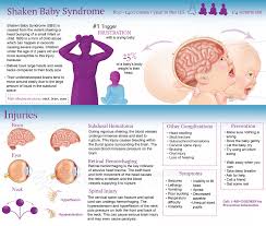 Shaken Baby Syndrome Ami Meeting 2020
