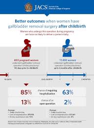 Leading service provider of gallbladder surgery services, liver cysts services, laparoscopic appendectomy services, laparoscopic cholecystectomy services, haemorrhoids & piles services and sphincterotomy for rectal fissure services from delhi. Gallbladder Removal Operation During Pregnancy Associated With Adverse Maternal Outcomes