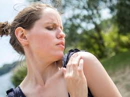 Acne aestivalis) sind stecknadelkopfgroße papeln mit schmalem, rötlichen rand und kleinen pusteln, die einen starken juckreiz auslösen1. Sonnenallergie Lastige Mallorca Akne Vermeiden Berlin De