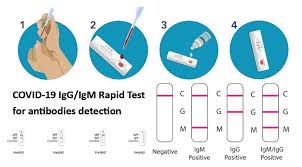Test sierologico covid19 privato presso il centro medico unisalus a milano, eseguito in conformità ai provvedimenti adottati dalla regione lombardia con dgr n. Test Sierologico Rapido Per Covid 19 Come Funziona