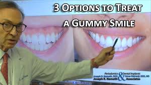 When teeth do not erupt properly, they are covered by a hyperactive lip muscle: 3 Options To Treat A Gummy Smile Doctors Advice Youtube