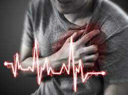 Cardiac arrest refers circulatory collapse with cessation of cardiac function that is either restored by resuscitative efforts (such as basic life support or aborted cardiac arrest (also called sudden cardiac arrest) refers to unexpected circulatory arrest occurring within 1 hour of onset of acute symptoms. Dealing With Sudden Cardiac Arrest Amidst The Pandemic Times Of India