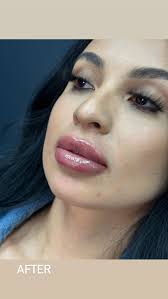 Buy the lips…., MAKE AN APPOINTMENT WITH US:, 🏰 @theskinelite , ☎️  210-800-9696, LOCATION:, 📍 2108 NW MILITARY HIGHWAY, CASTLE HILLS,  __________________________, 👩🏻‍⚕️ @theskindiva , Laura P. Galvan, ...