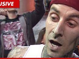 Travis Barker Nude Photo -- Stop Showing My Penis ... Or Else!