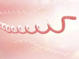 S'il évoque ce type de douleurs en plus. Lyme Une Nouvelle Piste Pour Reveler Les Formes Tardives Sciences Et Avenir