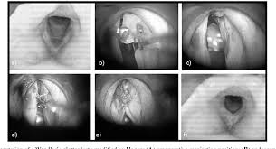 2015 may cited 2016 mar 18; Figure 1 From Pitch Elevation In Male To Female Transgender Persons The Wurzburg Approach Semantic Scholar