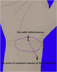 Image result for Point of Maximum Impulse