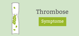 Je nach größe des thrombus macht sich dies für den betroffenen entweder wenig bemerkbar. Thrombose Anzeichen Symptome Thrombosezeichen Erkennen Pflege De