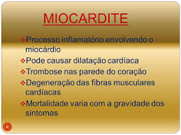 I primi casi sono accaduti in israele tra dicembre e maggio e sono stati 148 tra i 16 e i 19 anni. Doencas Infecciosas Do Coracao Ppt Video Online Carregar