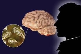 মানুষের মস্তিষ্কের কোষ দিয়ে তৈরি হবে কম্পিউটার! | চ্যানেল আই অনলাইন