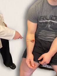 Image result for Reflex Exam