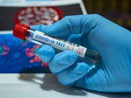 If you have been ill (more severe or mild), you can have the coronatest for antibodies performed at stadskliniek from 10 days after your first day of illness. Karnataka Corona Update Kolar Doctor 17 Others Finally Test Negative For Covid 19 Bengaluru News Times Of India