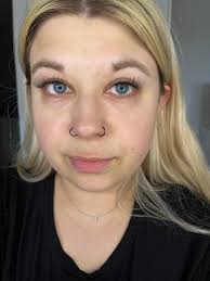 Hey girlies! wondering if anyone can help me! as you can see i have dark  circles 24/7! (they're worse in person + some days worse than others) drink  loads of water and