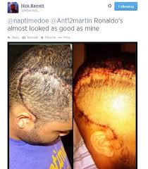 Share on pinterest share on facebook share on twitter. Bbctrending Why Does Cristiano Ronaldo Have Zigzag Hair Bbc News