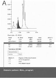 B Hplc Chromatograms With Interpretation The Hba1c Peak Is
