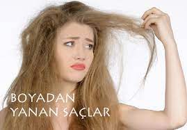 Nasil Anlasilir Boyadan Yanan Saclar Nasil Anlasilir