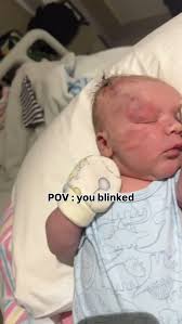 Happy 6 months Tommy the tornado 🌪️, 6 months ago, I nearly lost you and  then I nearly lost me in the weeks following. , What a ride but 6 months