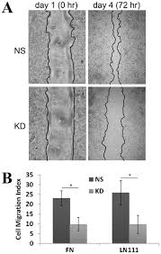 Trial, the active treatment was a cocoa beverage and provided 50 kcal and <1 g fat per day. Tetraspanin Co 029 Inhibits Colorectal Cancer Cell Movement By Deregulating Cell Matrix And Cell Cell Adhesions