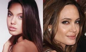 Last week was quite a busy week in the public relations office of asps. Angelina Jolie Plastic Surgery