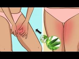 Cyst On Inner Thigh Near Groin Female Home Remedies For Boils On Private Area Youtube Home Remedy For Boils Hidradenitis Suppurativa Remedies Cysts