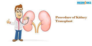 What Is Procedure Of Kidney Transplant In India Medmonks