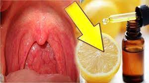 كيف أعالج طفلي من التهاب الحلق علاج التهاب الحلق عند الأطفال بالاعشاب