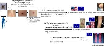 Wie ist die diagnose & therapie? Skin Interface A Key Player For Borrelia Multiplication And Persistence In Lyme Borreliosis Trends In Parasitology