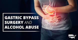 gastric byp surgery and alcohol abuse
