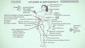 This article explores the signs and symptoms of a vitamin d deficiency, as well as possible complications, treatments, and when to see a doctor. 9 Signs Of Vitamin D Deficiency You Shouldn T Ignore Berkana Farm