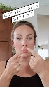 ✨ Skin Mapping Basics! ✨, Osmosis Skin Mapping is a revolutionary skincare  tool inspired by holistic healing and wellness that helps us understand  what our skin is trying to say., When redness, acne, ...