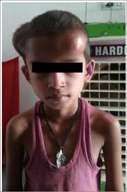 2019 CIS Annual Meeting: Immune Deficiency & Dysregulation North American  Conference