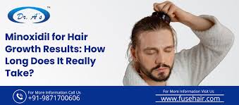 Image result for Minoxidil