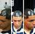 Beijing Hair Before And After