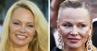 Pamela Anderson er nu 57 år gammel og vælger at afsløre sit 'naturlige'  ansigt