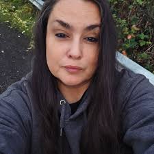 Why do amputees experience burning leg pain?