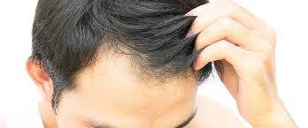 Even though your hair may already be long, regular cutting is important to keep the ends healthy. When Should The Groom Have Hair Transplant Arabia Weddings