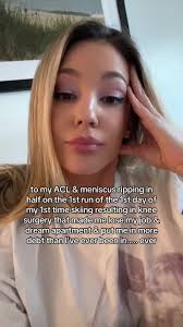 Knee Surgery Mishap: A Funny and Relatable Journey