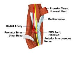 Pronator Syndrome Hand Orthobullets