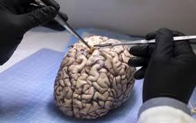 Corpul uman cu organele interne. Proiectul Ambitios Al Sua 10 Ani Si 3 Miliarde De Dolari Pentru A Afla Misterele Creierului Uman Stirileprotv Ro