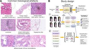 We did not find results for: Quality Control Stress Test For Deep Learning Based Diagnostic Model In Digital Pathology Modern Pathology