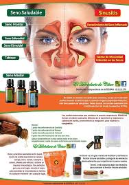 sinusitis niños doterra